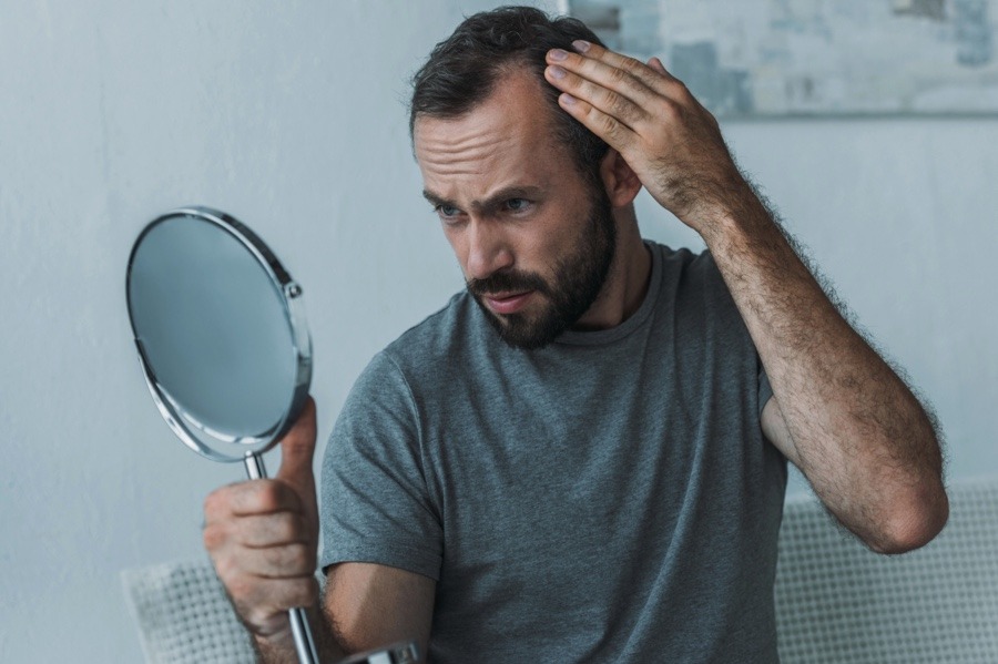 Restore Your Hairline
