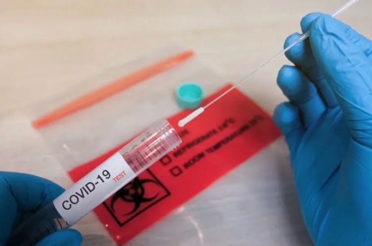 Covid Testing in Rancho Santa Fe